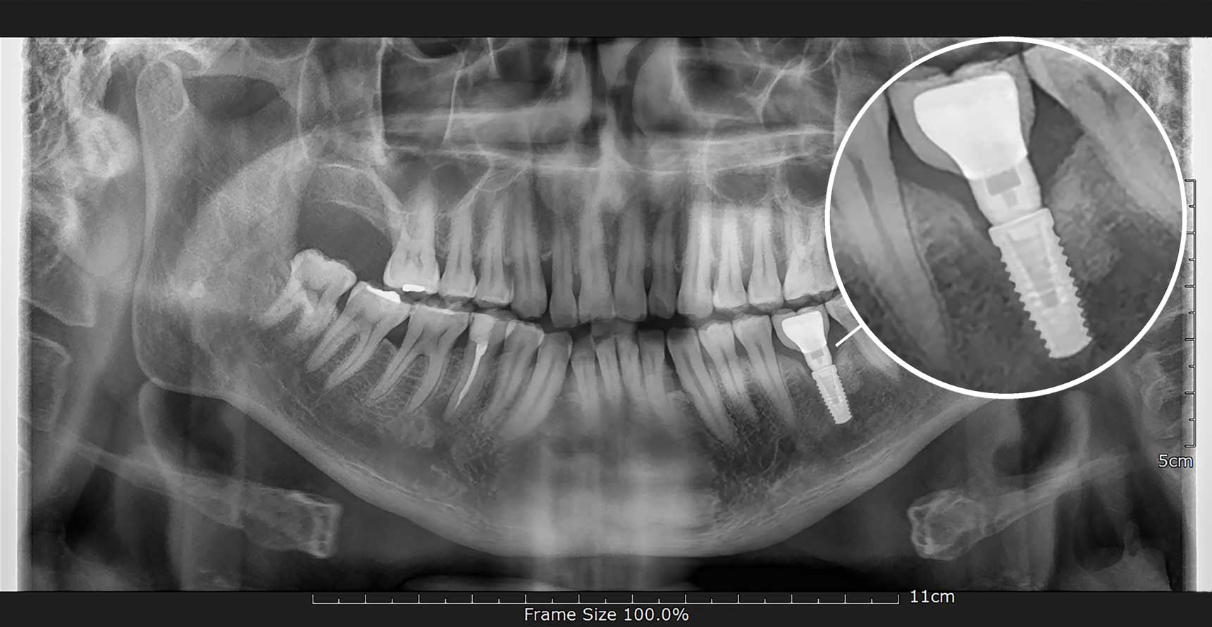 dental x-rays